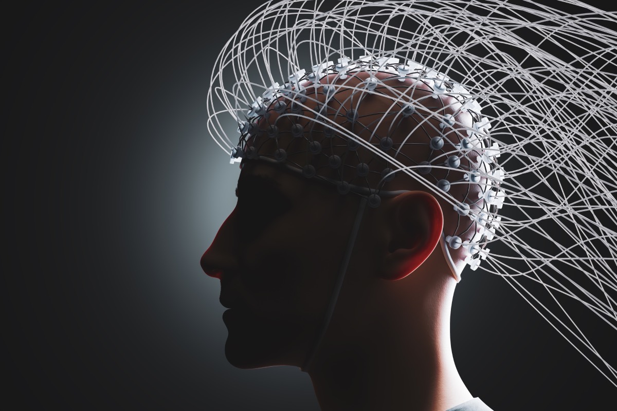 Propofol on Brain Circuits