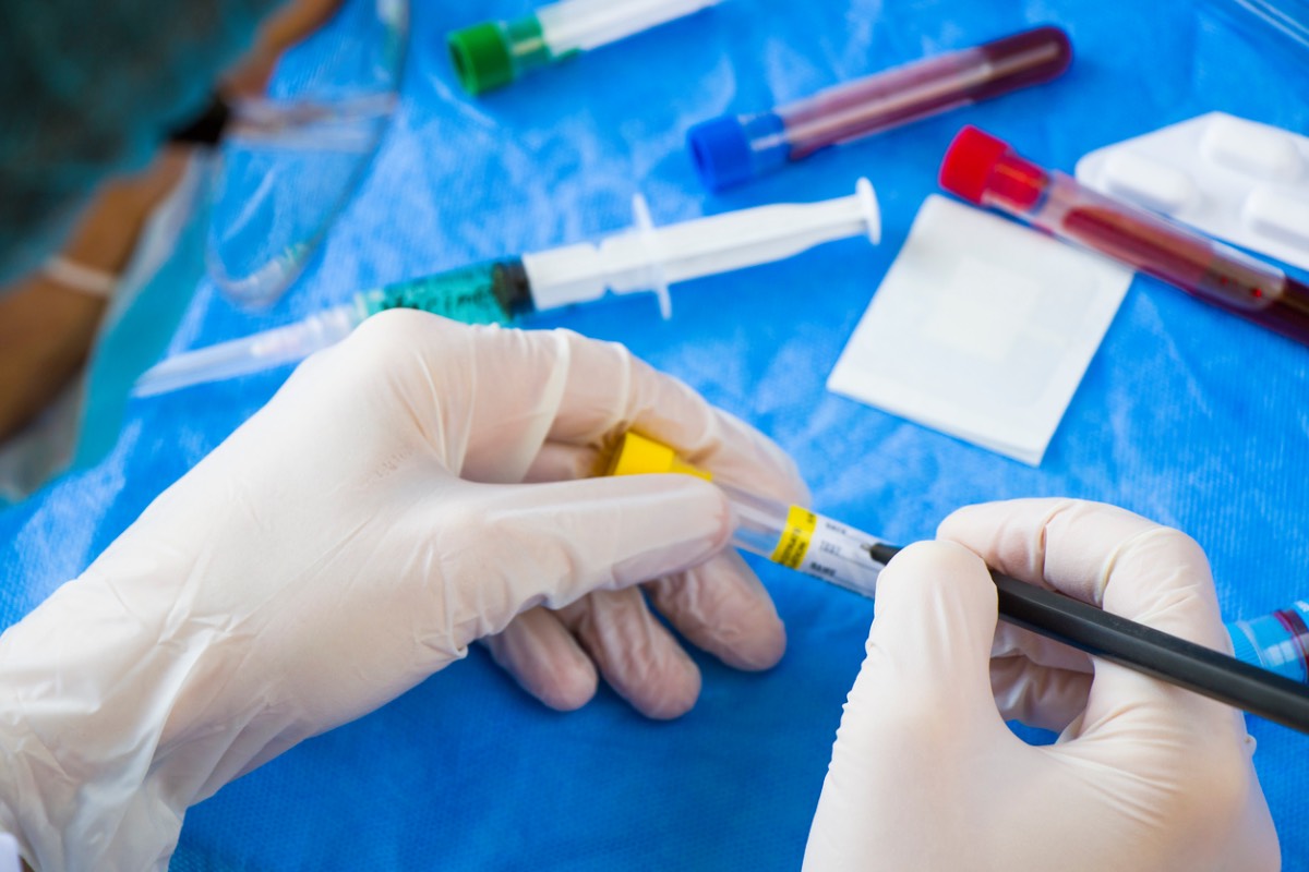 Testing INR Before Surgery